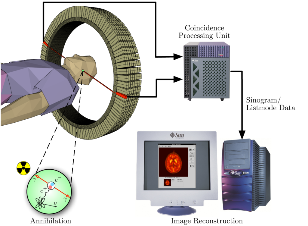 A diagram which illustrates the function of a PET machine. A scanner detects the emissions of the short-lived radioactive isotope in the brain of the subject, transmits this information to a Coincidence Processing Unit, which is subsequently used to reconstruct an image of the subject's brain activity.